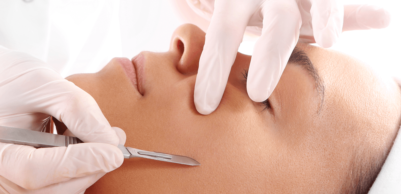 Dermaplaning